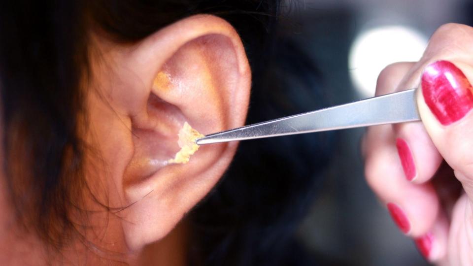 ear wax removal near me today